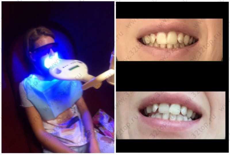 Салон косметического отбеливания зубов WHITE & SMILE
